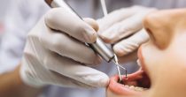 zubi zubar dentist stomatologija